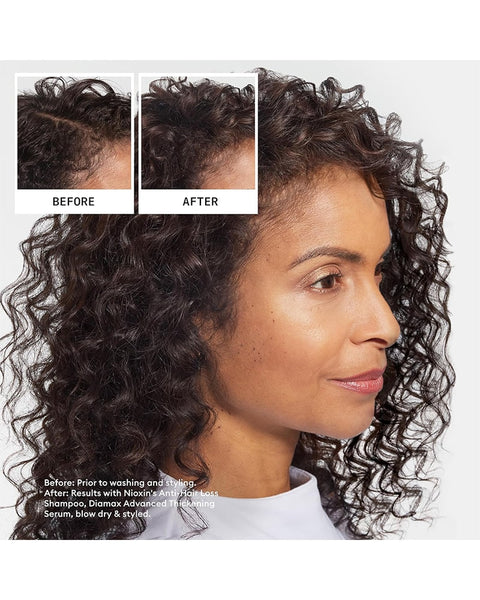 Nioxin Ultimate Power Hair Fall Defense Shampoo